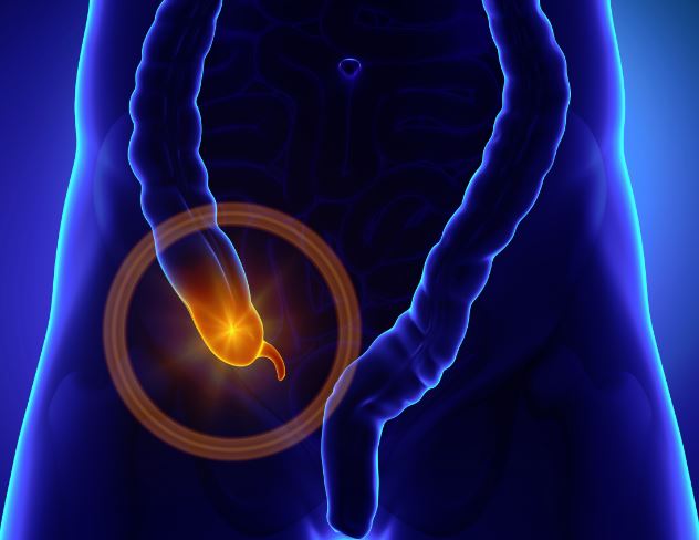 signos de la apendicitis