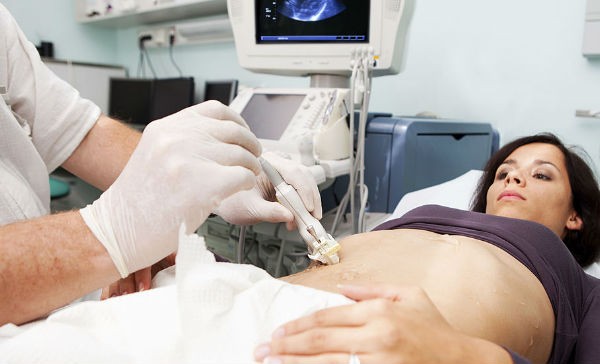 esteatosis hepática difusa