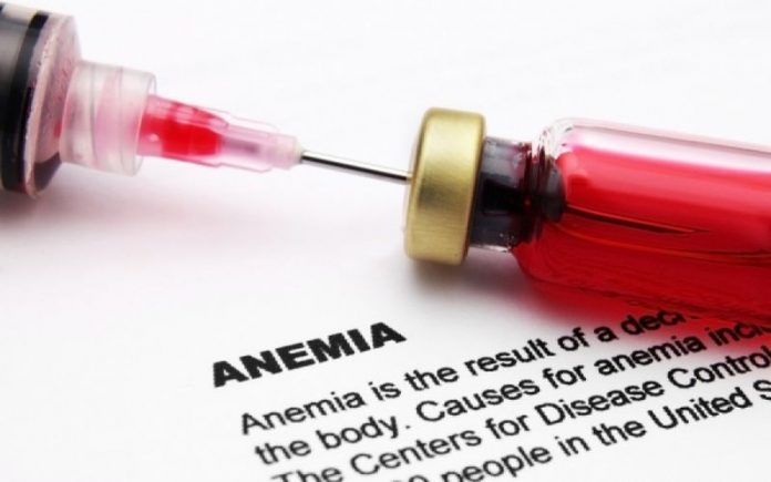 anemia perniciosa y gastritis autoinmune anemia perniciosa y gastritis autoinmune