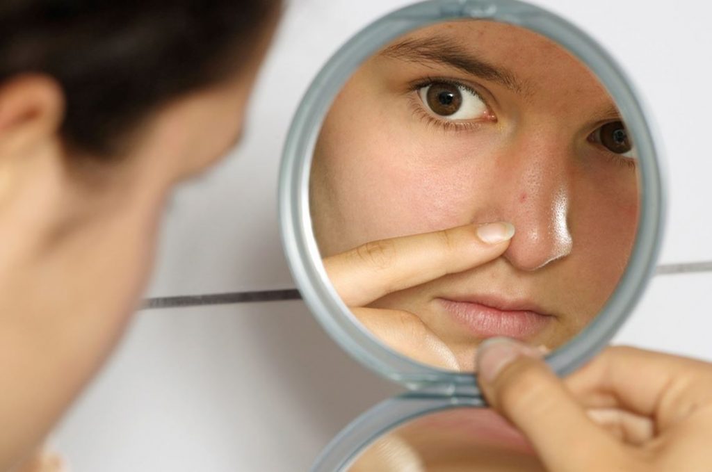 cola de caballo para el acne