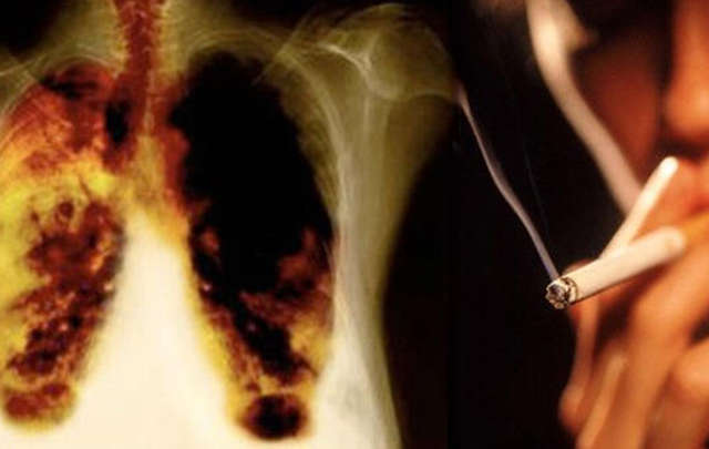 fumar con enfisema pulmonar