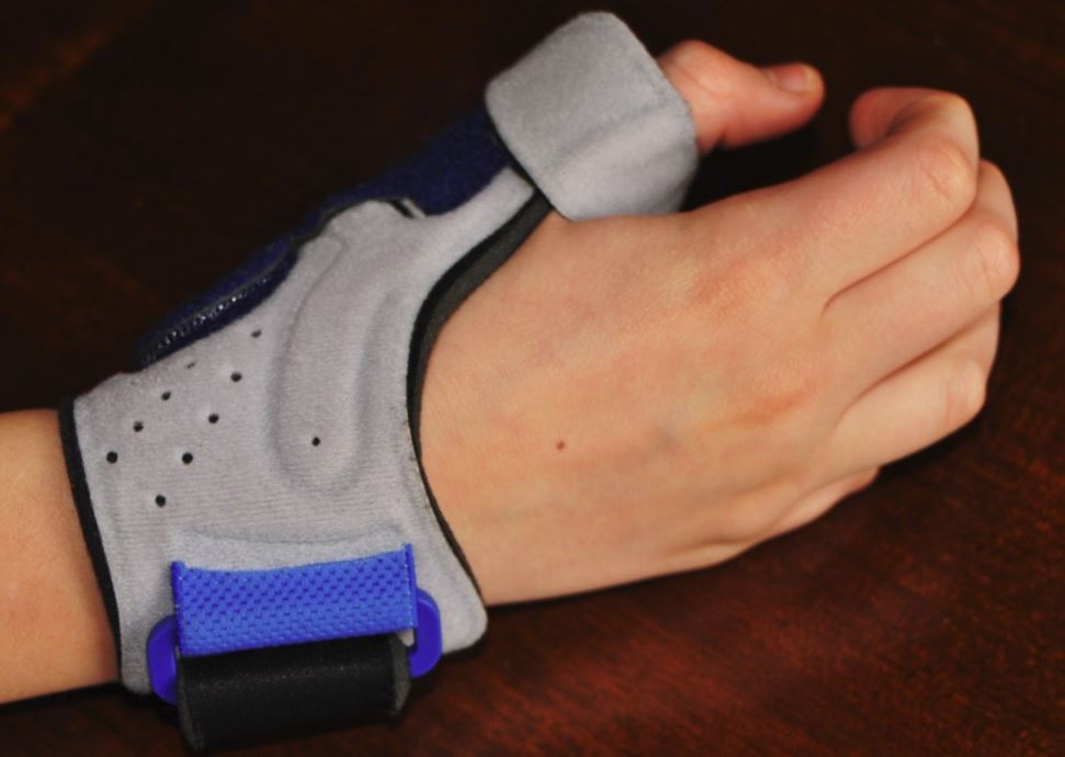 tratamiento tendinitis de quervain fisioterapia