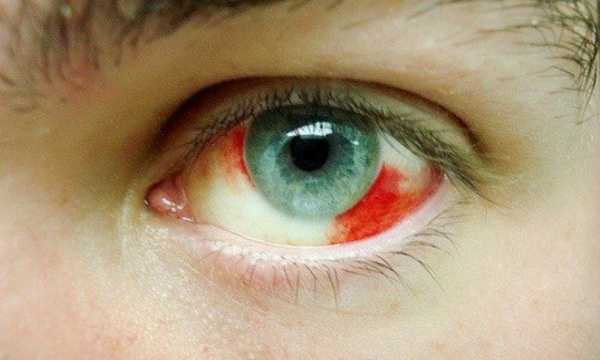 dolor en un ojo por dentro