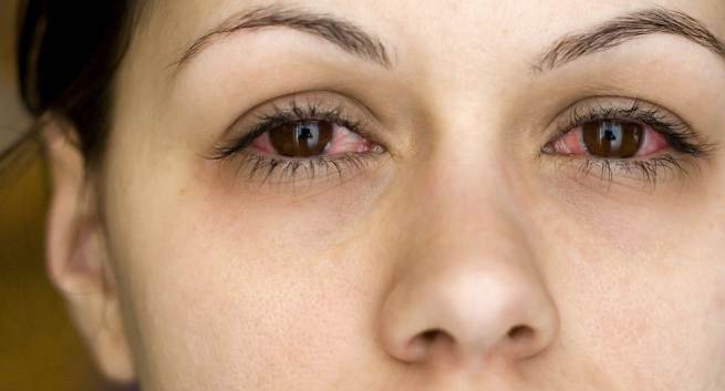 ojos rojos causas