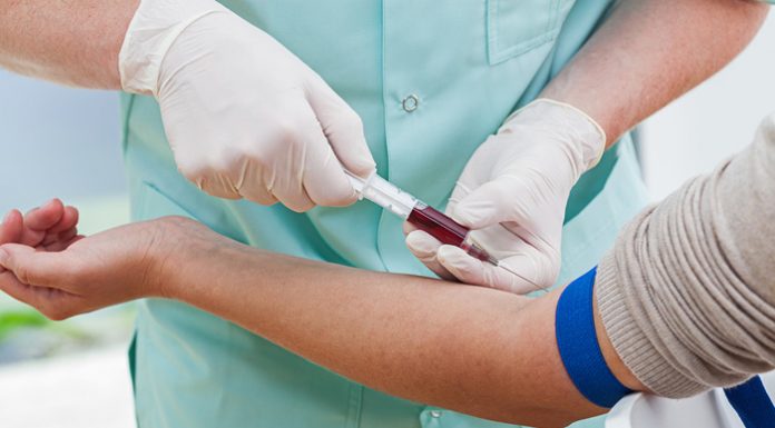 Anemia megaloblástica; Causas, diagnóstico, síntomas, tratamiento y mucho más vitamina b12 anemia