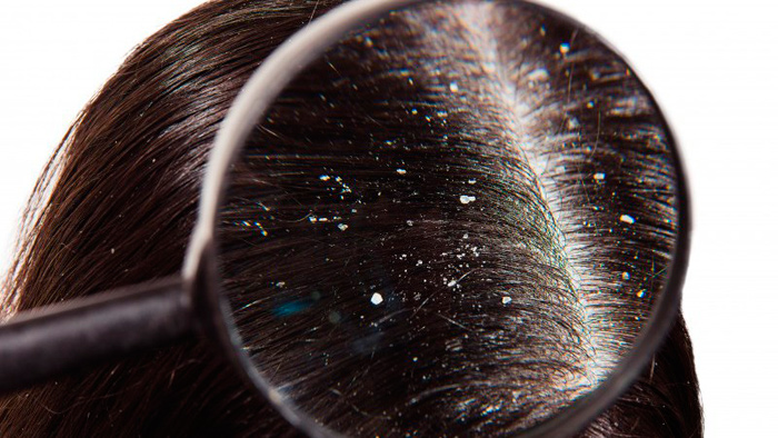 beneficios rosa mosqueta