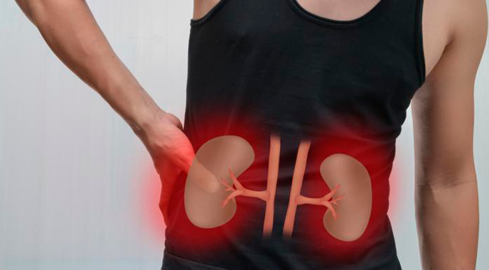 cloruro de manganeso formula