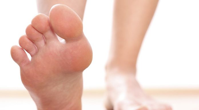 fascitis plantar que es