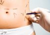 beneficios de la cirugía estética