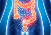 que es colon irritable sintomas