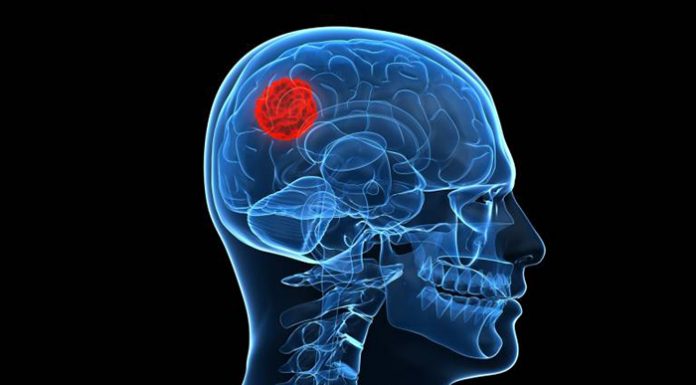 bultos parte atras cuello