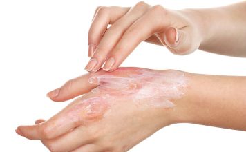 Las mejores cremas para quemaduras leves; ¡Muy efectivas! gel para quemaduras