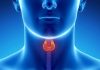 tratamiento homeopatico para hipotiroidismo subclinico