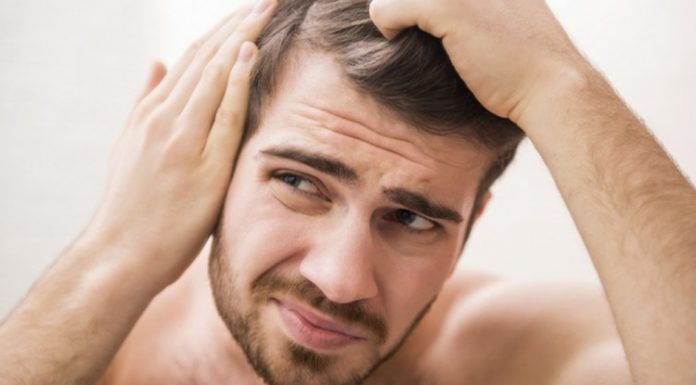 alergia minoxidil sintomas