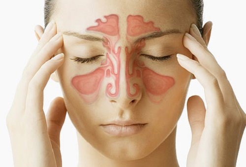 congestión nasal dolor de cabeza congestión nasal dolor de cabeza