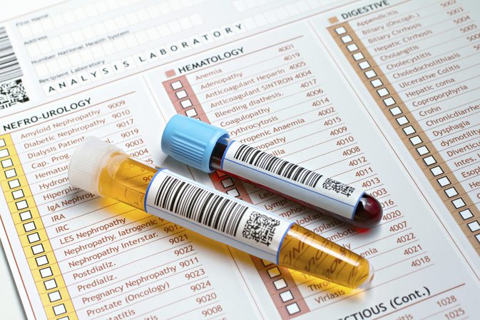 hematuria en orina valores normales