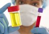 sangre en orina sin infeccion causas