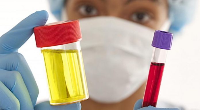 sangre en orina sin infeccion causas