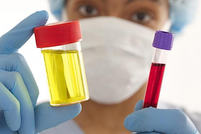 sangre en orina sin infeccion causas