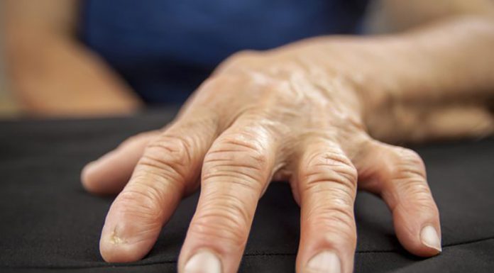 artrosis medicina natural