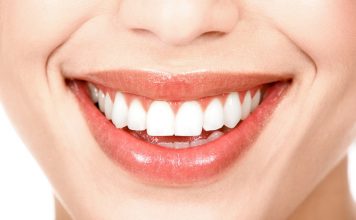 blanqueamiento dental madrid