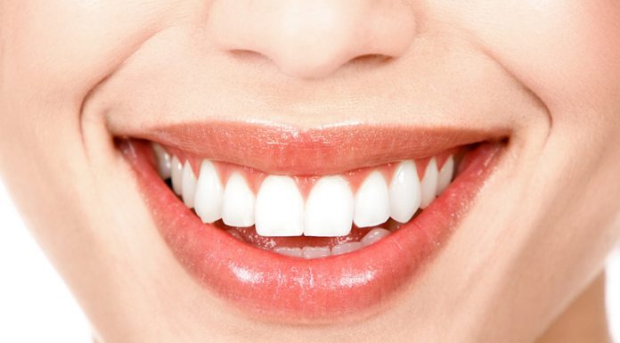 9 beneficios de un blanqueamiento dental profesional blanqueamiento dental madrid