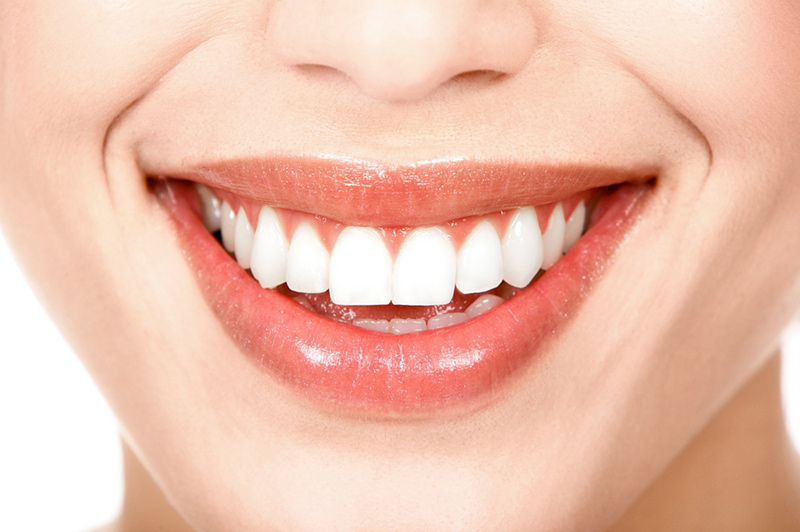 blanqueamiento dental madrid blanqueamiento dental madrid