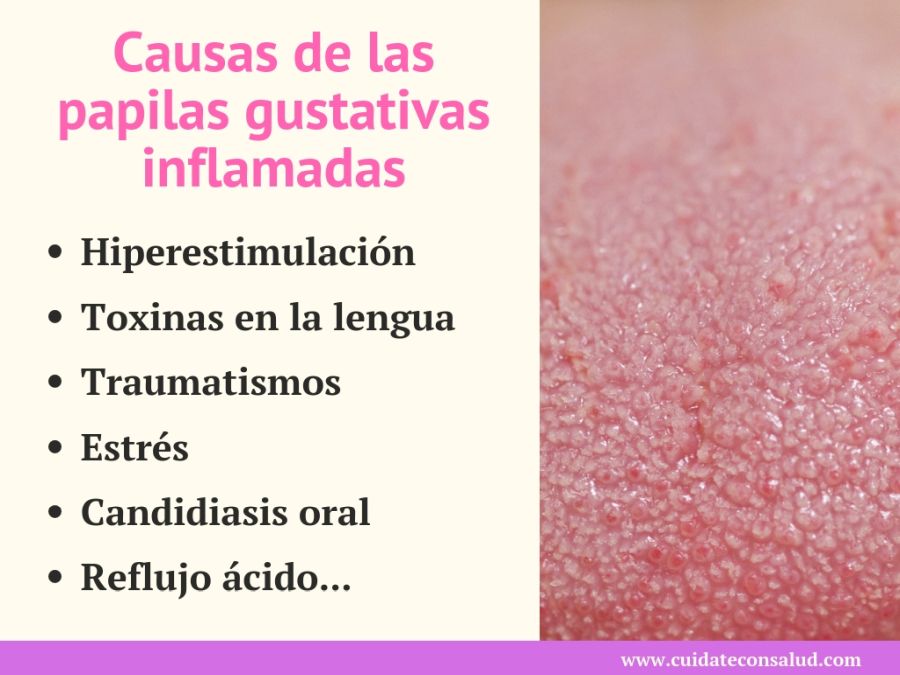 causas de inflamacion de las papilas gustativas