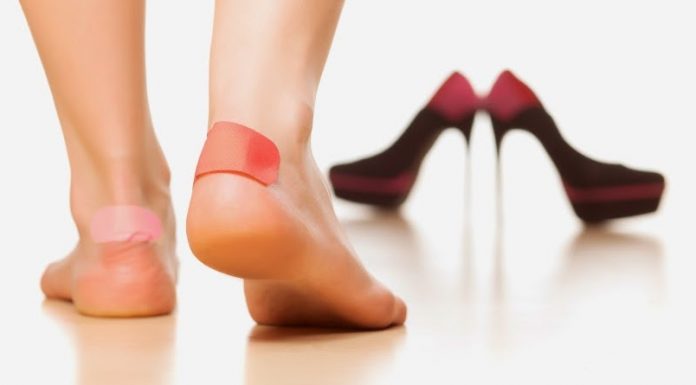 Cómo tratar las rozaduras de los pies como curar rozaduras en los pies