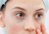 como quitar las ojeras