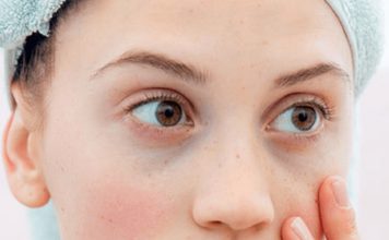 6 remedios caseros para quitar las ojeras como quitar las ojeras