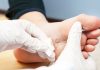 verrugas plantares en niños tratamiento