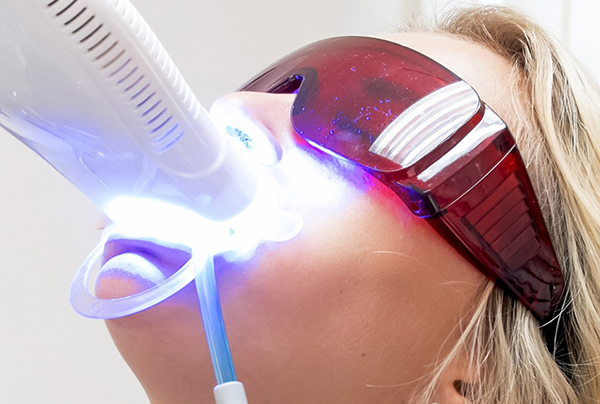 blanqueamiento dental barcelona blanqueamiento dental barcelona