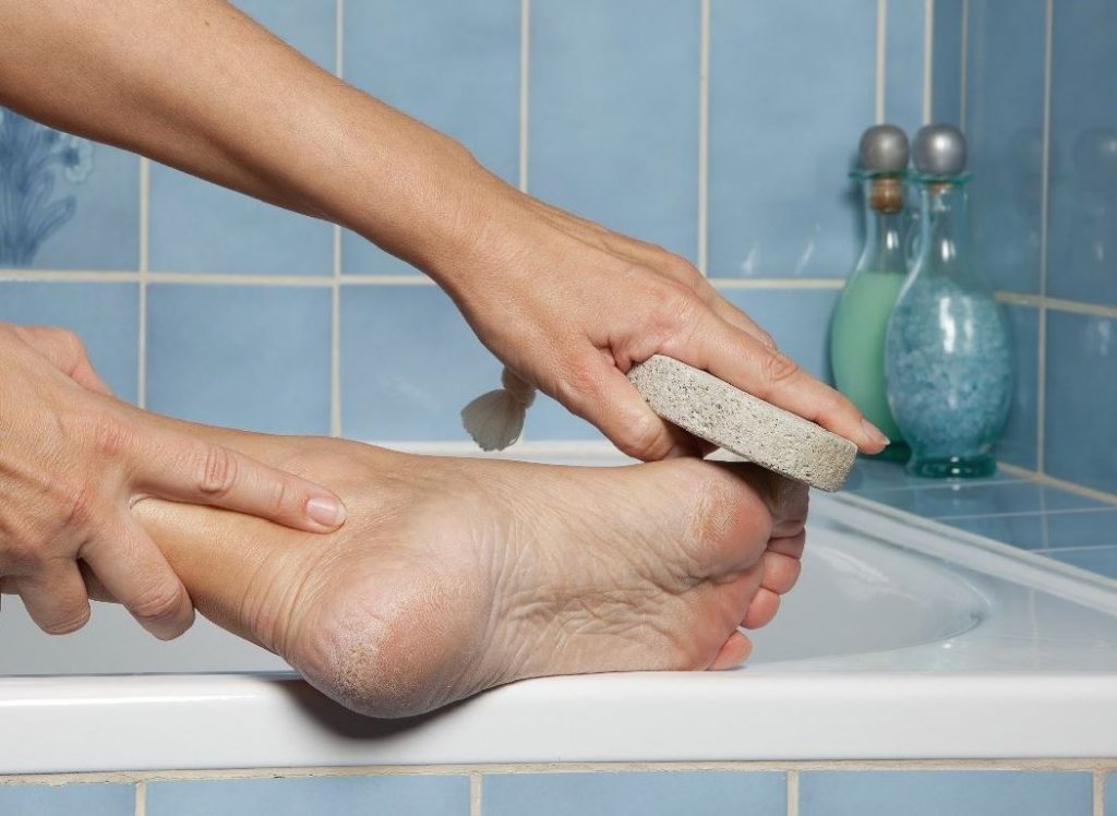 piedra pómez para quitar callos piedra pómez para quitar callos