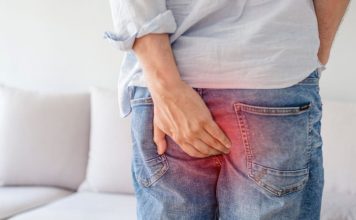 remedios caseros para las hemorroides