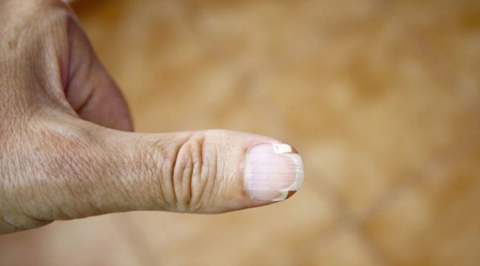 tratamiento para uñas quebradizas y debiles
