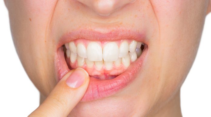 Dientes y encías más sanas con Waterpik encías más sanas