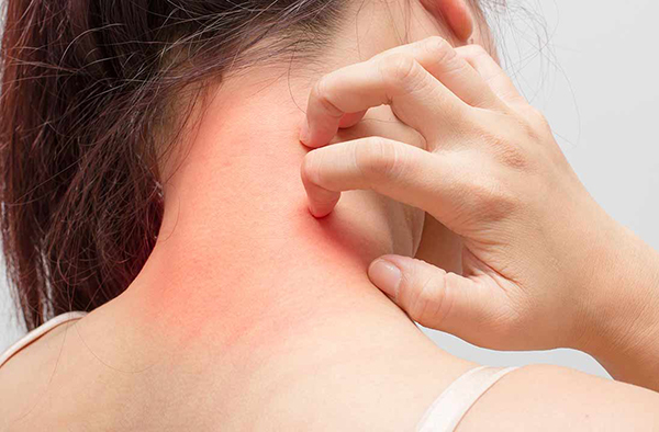 propiedades del pimentón de la vera propiedades del pimentón de la vera