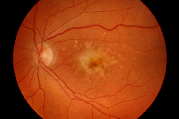azafran y curcuma es lo mismo azafran y curcuma es lo mismo