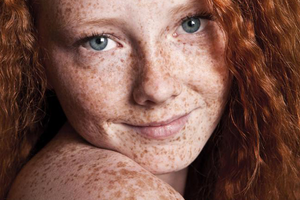 porque salen manchas en la piel porque salen manchas en la piel