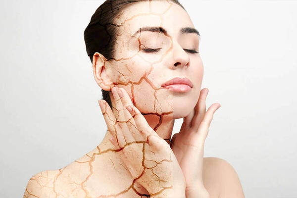 como hidratar la piel sin cremas como hidratar la piel sin cremas