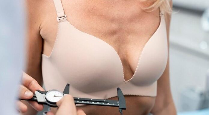 Mastopexia con o sin prótesis ¿cuál elegir? que es la mastopexia